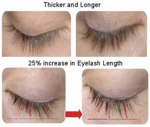 best eyelash growth