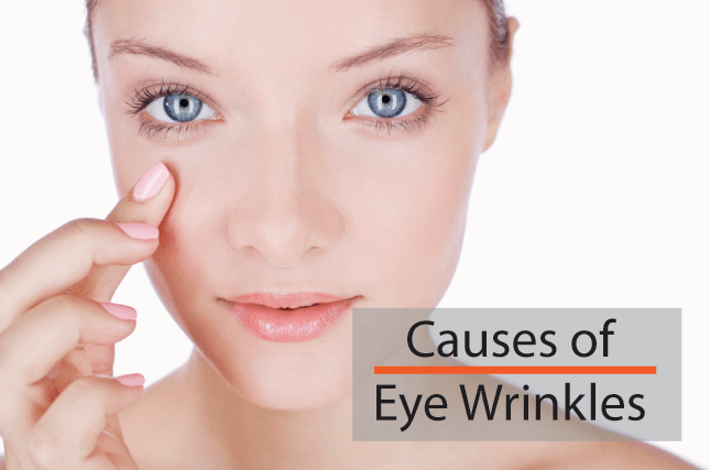 Causes of Eye Wrinkles